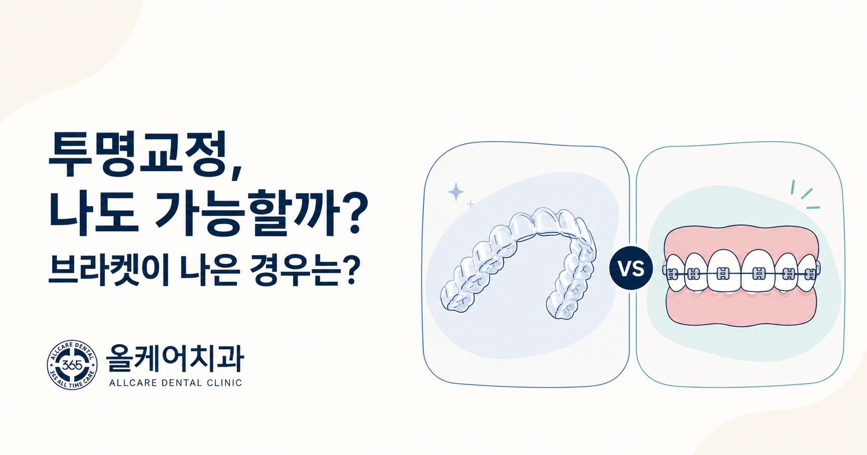 신당동 약수 치아교정, 투명교정이 가능한 경우와 브라켓 교정이 나은 경우