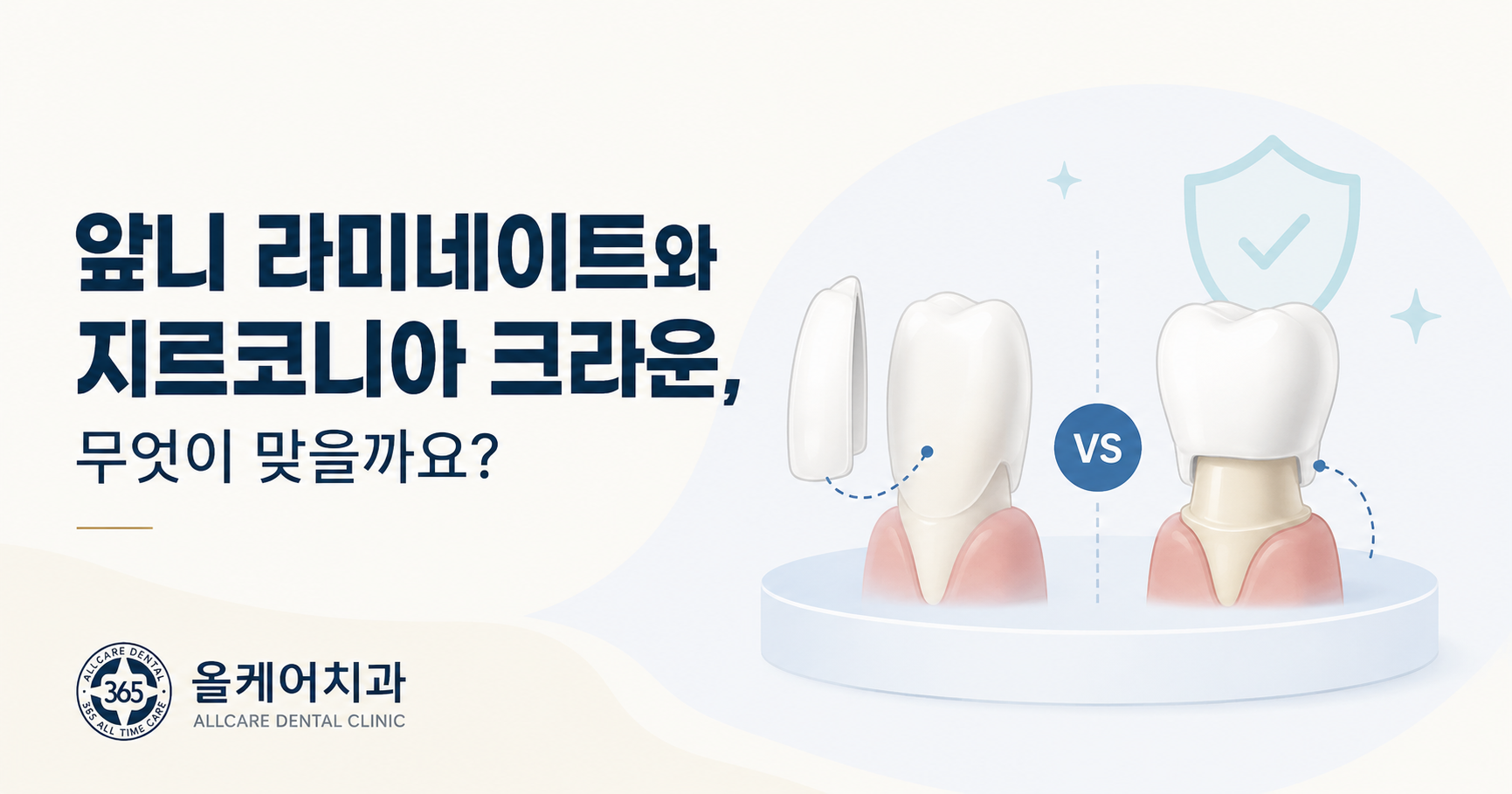 앞니에 얇게 붙이는 라미네이트와 치아 전체를 감싸는 지르코니아 크라운의 구조 비교