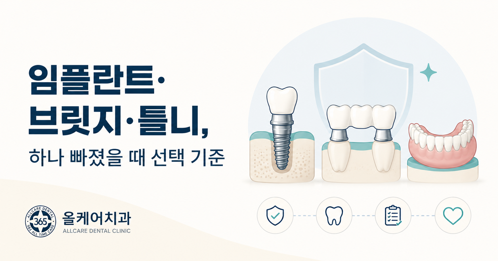 양옆 치아 사이에 하나가 빠진 자리를 무엇으로 채울지 보여주는 일러스트
