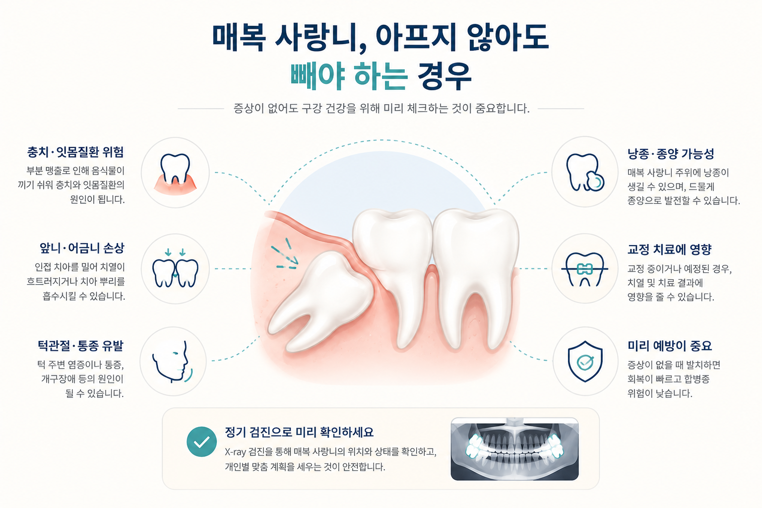 매복 사랑니, 아프지 않아도 빼야 하는 경우