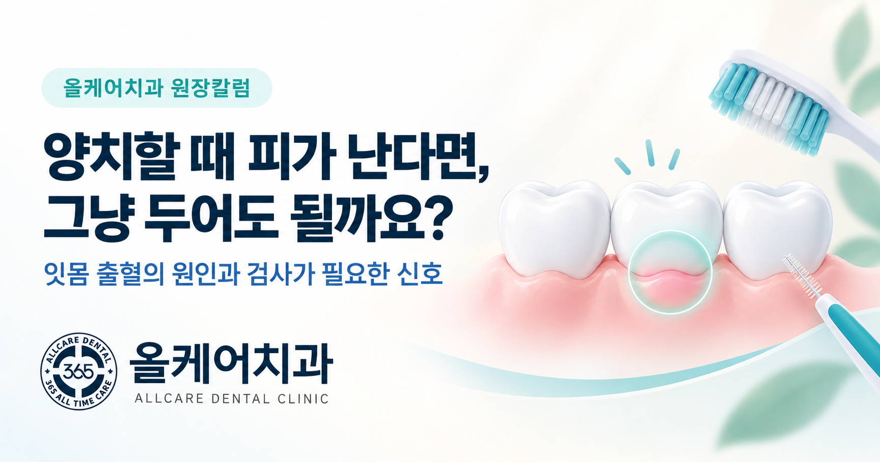 한남동 잇몸에서 피가 나요, 그냥 두어도 될까요?