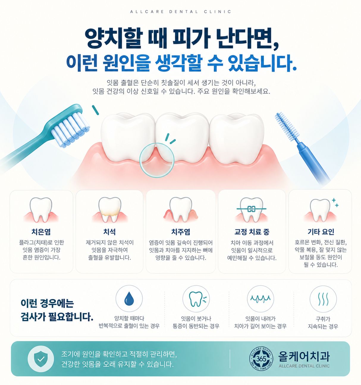 잇몸 출혈의 원인과 검사의 필요성