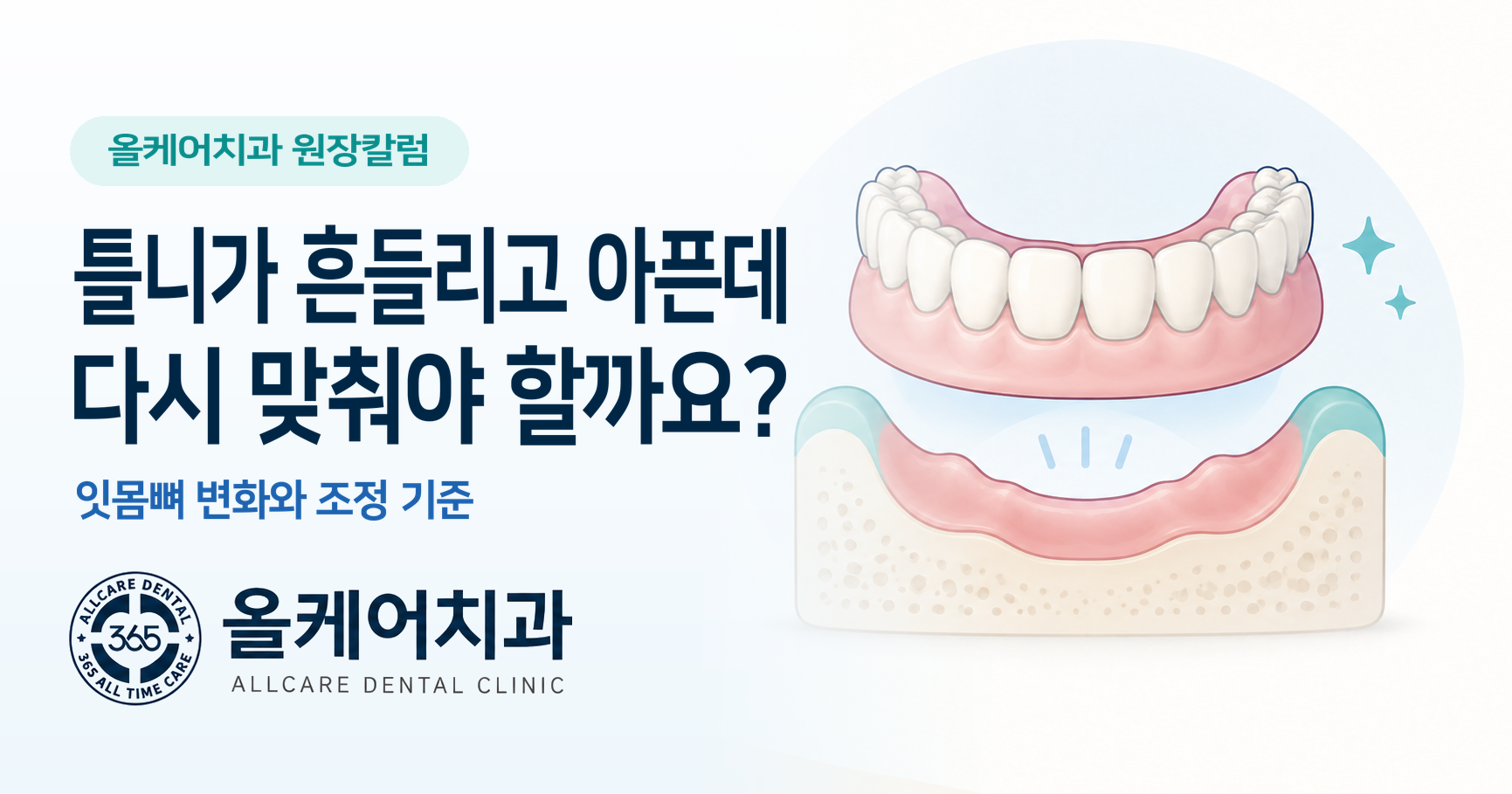 다산동 틀니가 흔들리고 아픈데, 다시 맞춰야 할까요?