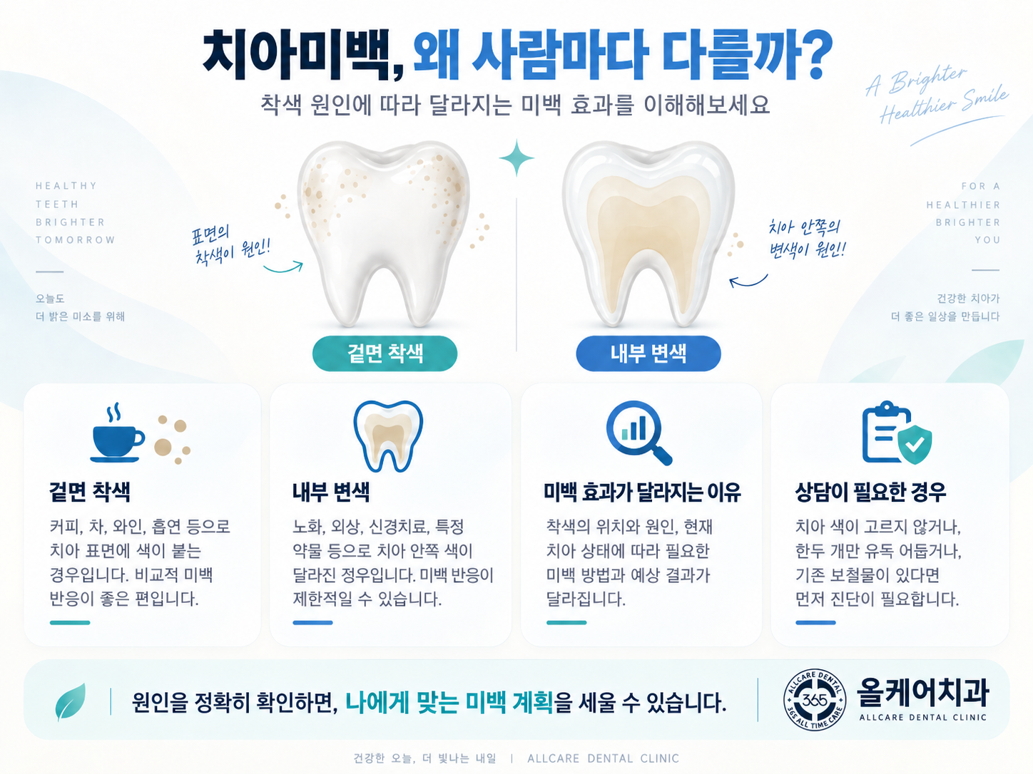 착색 원인에 따라 치아미백 효과가 달라지는 기준을 정리한 도해