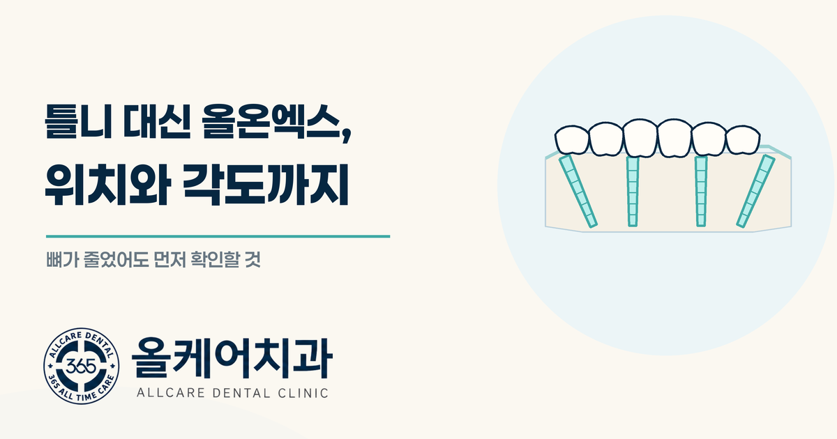 용산 틀니가 흔들려 못 씹는다면, 올온엑스가 방법일까요?