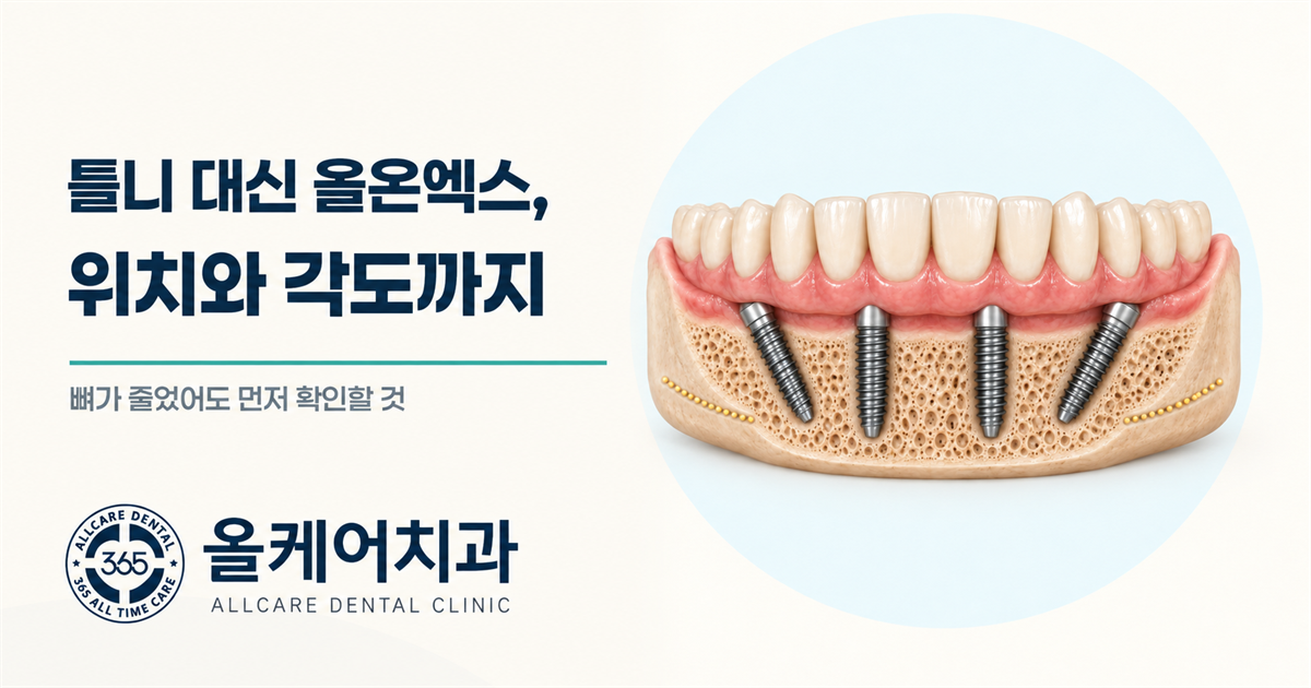 용산 틀니가 흔들려 못 씹는다면, 올온엑스가 방법일까요?
