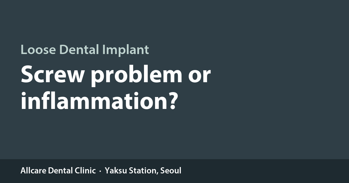 Why Does My Dental Implant Feel Loose? Screw Loosening vs. Inflammation