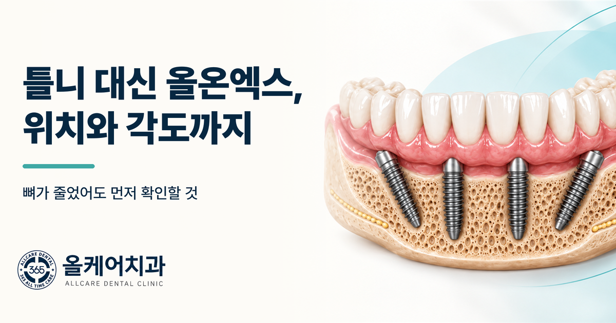용산 틀니가 흔들려 못 씹는다면, 올온엑스가 방법일까요?