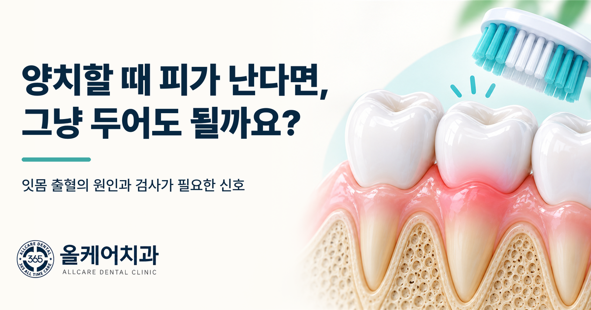 잇몸 출혈의 원인과 검사가 필요한 신호를 정리한 안내 이미지