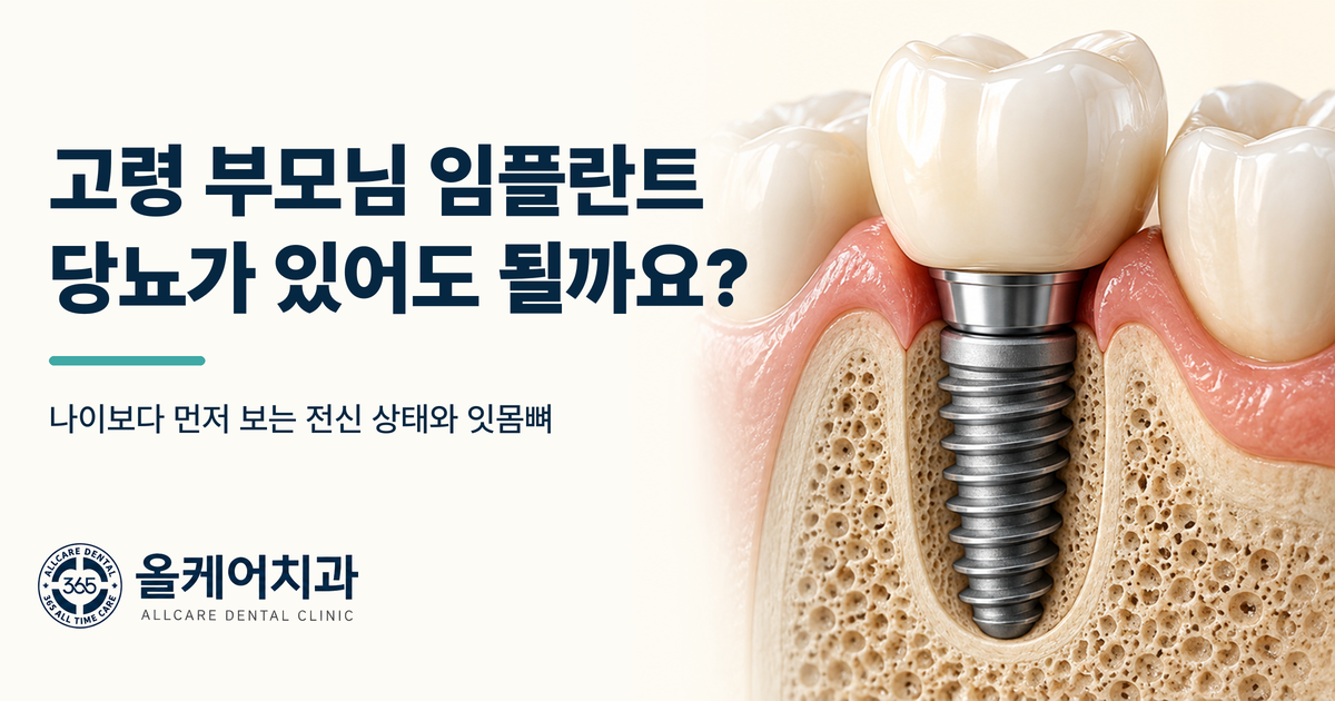 고령 부모님 임플란트 가능 기준을 설명하는 올케어치과 원장칼럼 이미지